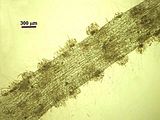 Tallo con sori di organi uniloculari